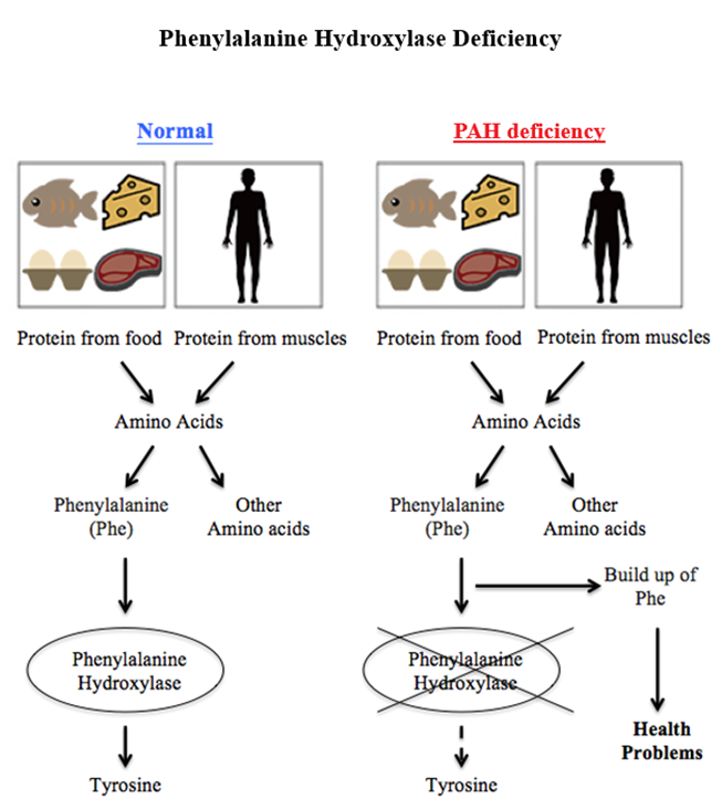 Phenylalanine Hydroxylase Deficiency diagram